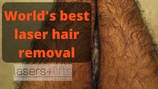 Worlds best hair removal laser [upl. by Nnail42]