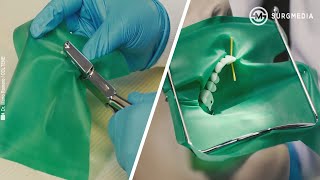 Basics of Dental Rubber Dam Placement [upl. by Alliber]