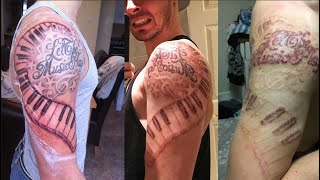 Laser Tattoo Removal  Full Experience [upl. by Yllim]