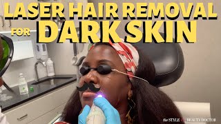 Getting Laser Hair Removal on Dark Skin Cutera 1064 Laser [upl. by Aristotle]