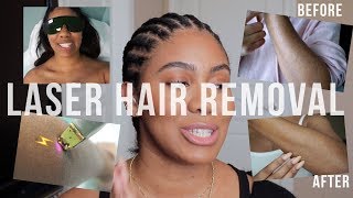 Laser Hair Removal Things To Know  Before amp After  zoerudd [upl. by Deni85]