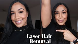 Laser Hair Removal VLOG  Waxing vs Laser  My Experience [upl. by Lehcor]