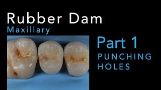 Rubber Dam Isolation Part 1 Punching Maxillary Holes [upl. by Eillim212]